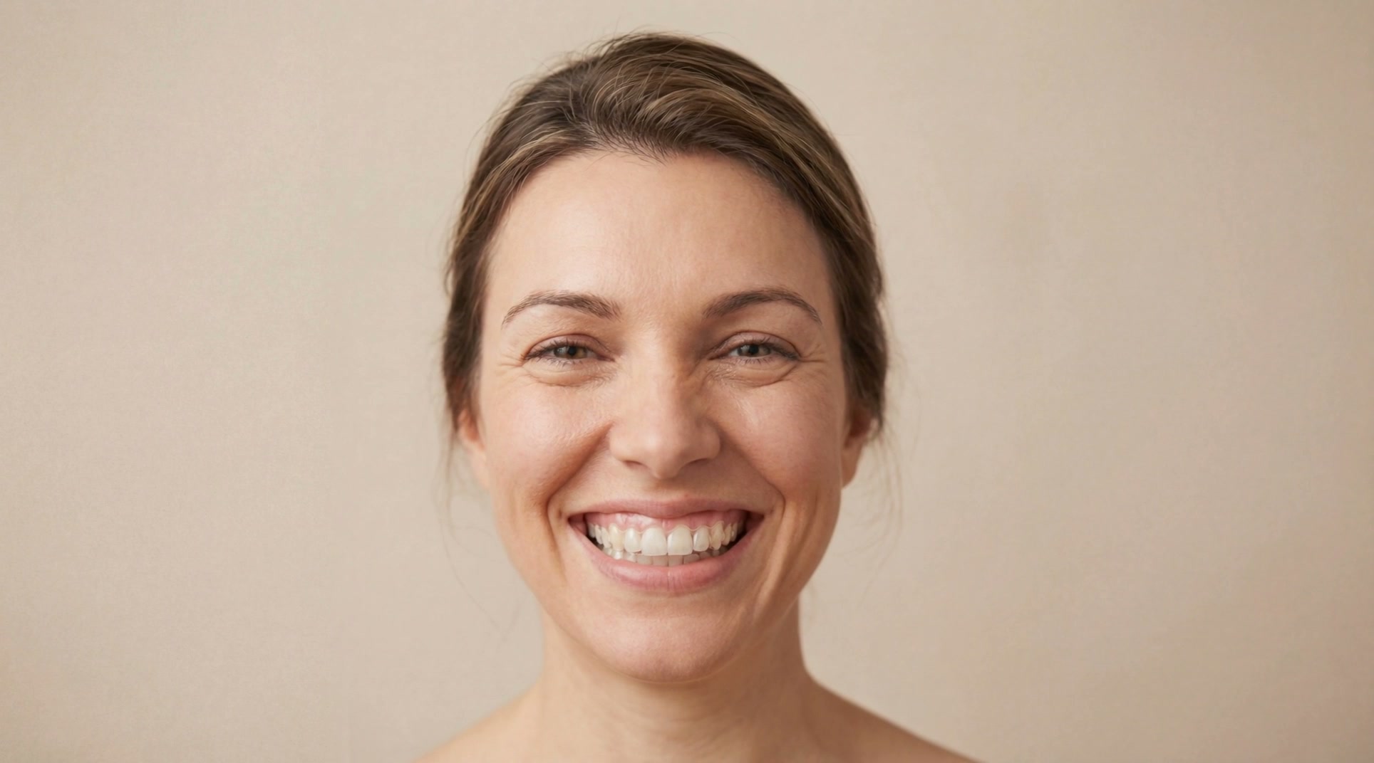 Woman with a straight, healthy smile after orthodontic treatment in Zurich
